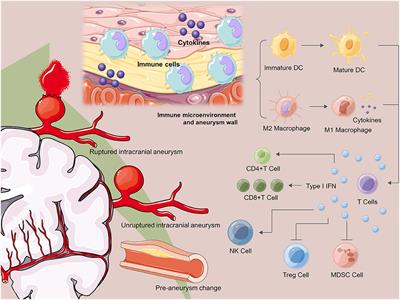 Editorial: Immunology and inflammation in intracranial aneurysms